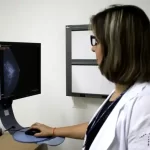 Entidades médicas pedem faixa etária maior para mamografia de rastreio
