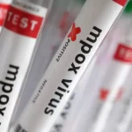 Região Norte do Brasil registra casos de mpox