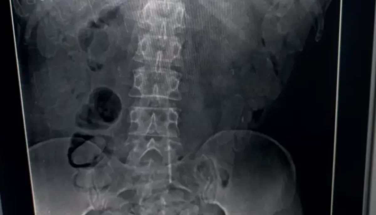 Foto: Divulgação/Polícia Militar Rodoviária